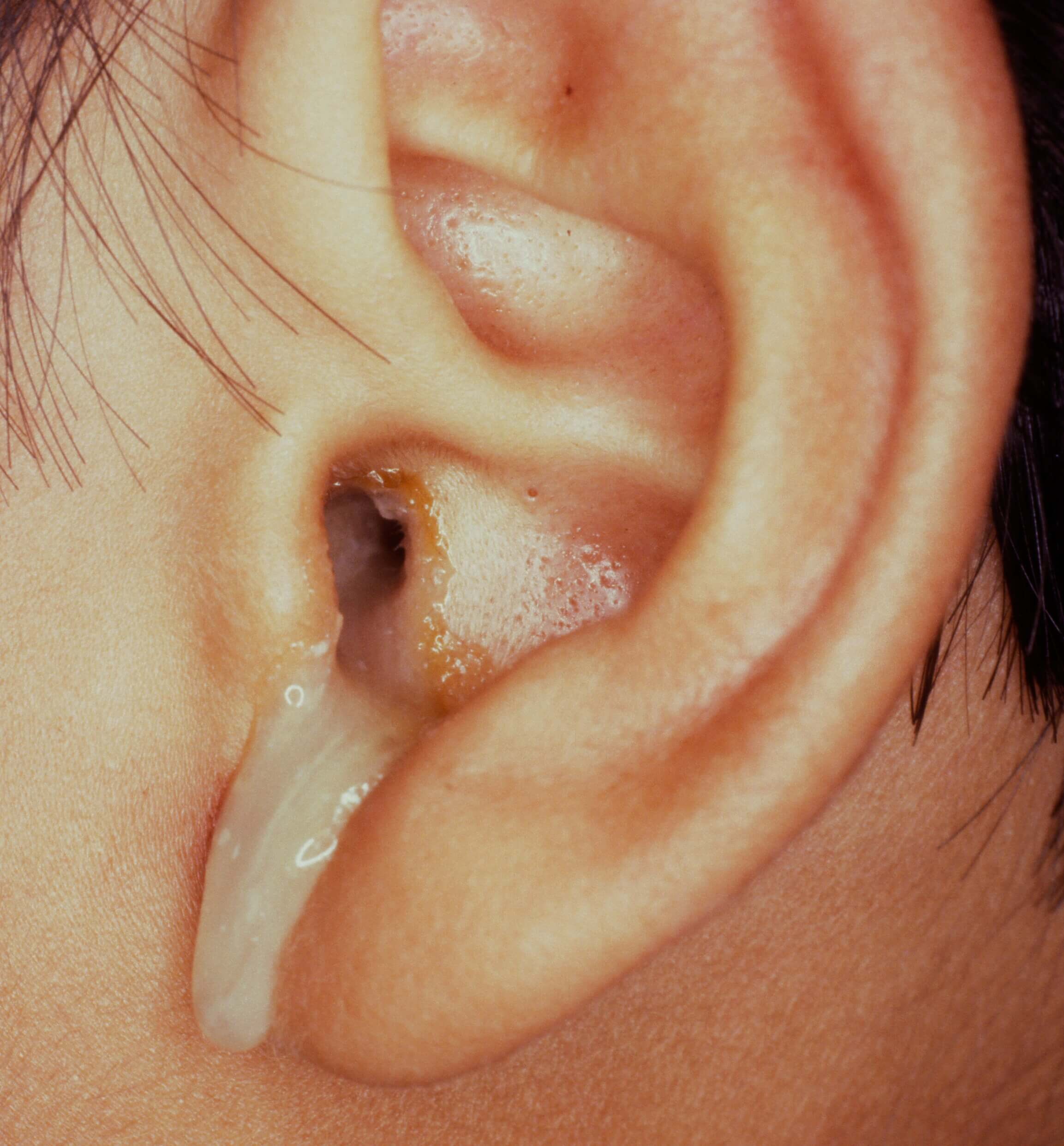 Ear Examination