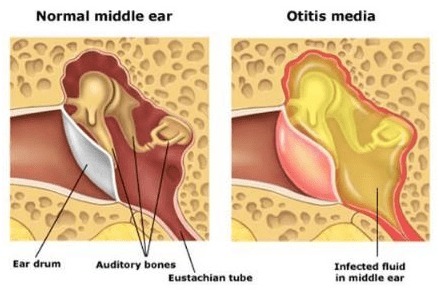 Neurotology Surgery
