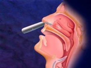 Nasal cauterisation
